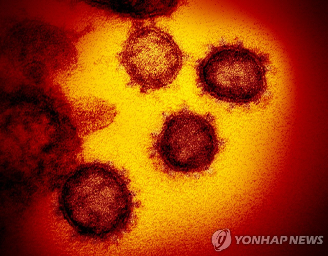 ▲ 신종 코로나바이러스의 전자현미경 이미지